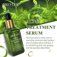 BREYLEE Acne Treatment Serum 17 ml