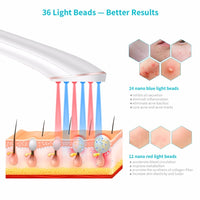 Acne Light Therapy Xpreen Treatment Device: Wireless Rechargeable with Blue Light and Red Light