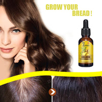 EELHOE Ginger Hair Care - Prevents Hair Loss