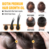 EELHOE Biotin Hair Growth Oil