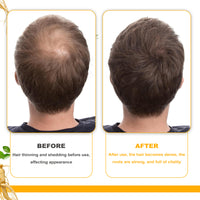 EELHOE Biotin Hair Growth Oil