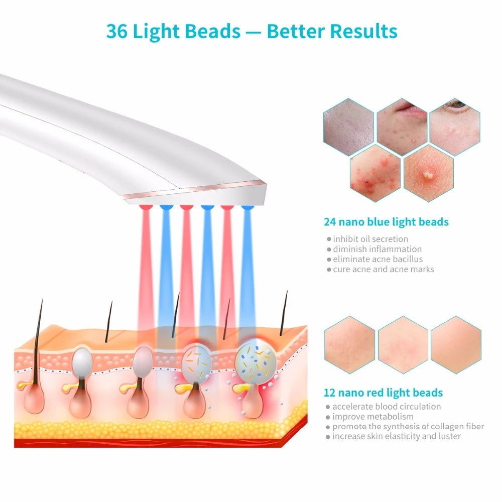 Acne Light Therapy Xpreen Treatment Device: Wireless Rechargeable with Blue Light and Red Light