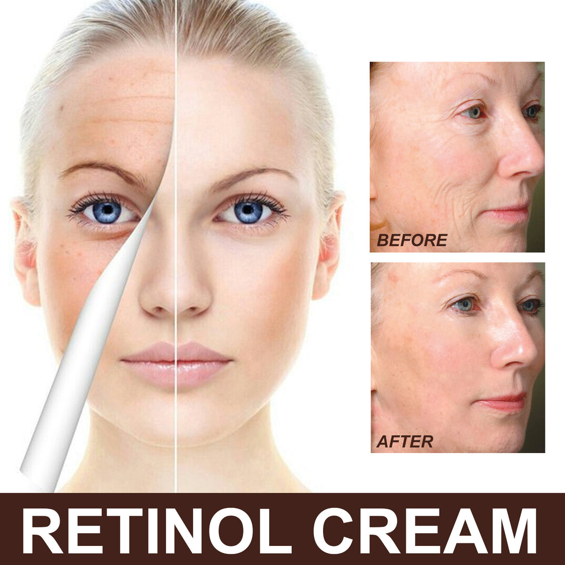 EELHOE Retinol Cream (Anti-Aging, Wrinkle Removal, Skin Firming)