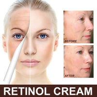 EELHOE Retinol Cream (Anti-Aging, Wrinkle Removal, Skin Firming)