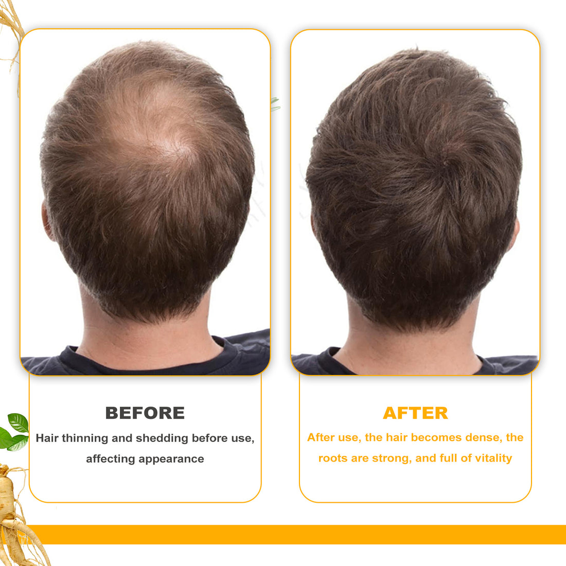 EELHOE Biotin Hair Growth Oil