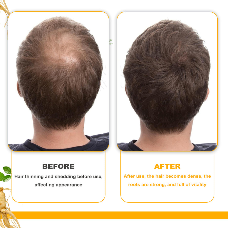 EELHOE Biotin Hair Growth Oil