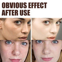 EELHOE Retinol Cream (Anti-Aging, Wrinkle Removal, Skin Firming)