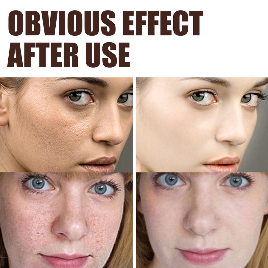 EELHOE Retinol Cream (Anti-Aging, Wrinkle Removal, Skin Firming)